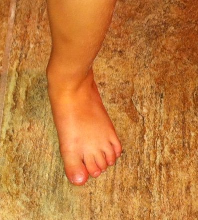 Child's Foot showing flexibility of toes
